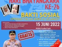 Dalam Rangka Menyambut Hari Bhayangkara ke-76 Bid Dokkes Polda Sumsel Akan Menggelar Operasi Bibir Sumbing