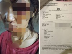 Remaja di Bima Alami Luka Serius Lantaran Diduga Dianiaya Sang Pacar, Keluarga Desak Polisi Tangkap Terduga Pelaku