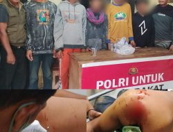 Diduga Dipicu Dendam Lama, Seorang Mahasiswa di Bima Dibacok