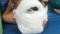 Tawuran Antar Warga kembali Terjadi, Memakan Korban