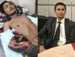Amputasi Dua Tangan Korban Tersengat Aliran Listrik, Kuasa Hukum Desak Pertanggungjawaban PLN Bima