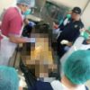 Polisi Selidiki Penemuan Mayat Misterius di Perbukitan Pemenang
