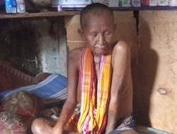 Viral! Pasien Kusta di Bima Mengaku Tak Mendapat Penanganan di Puskesmas Woha Lantaran Tak Punya KTP